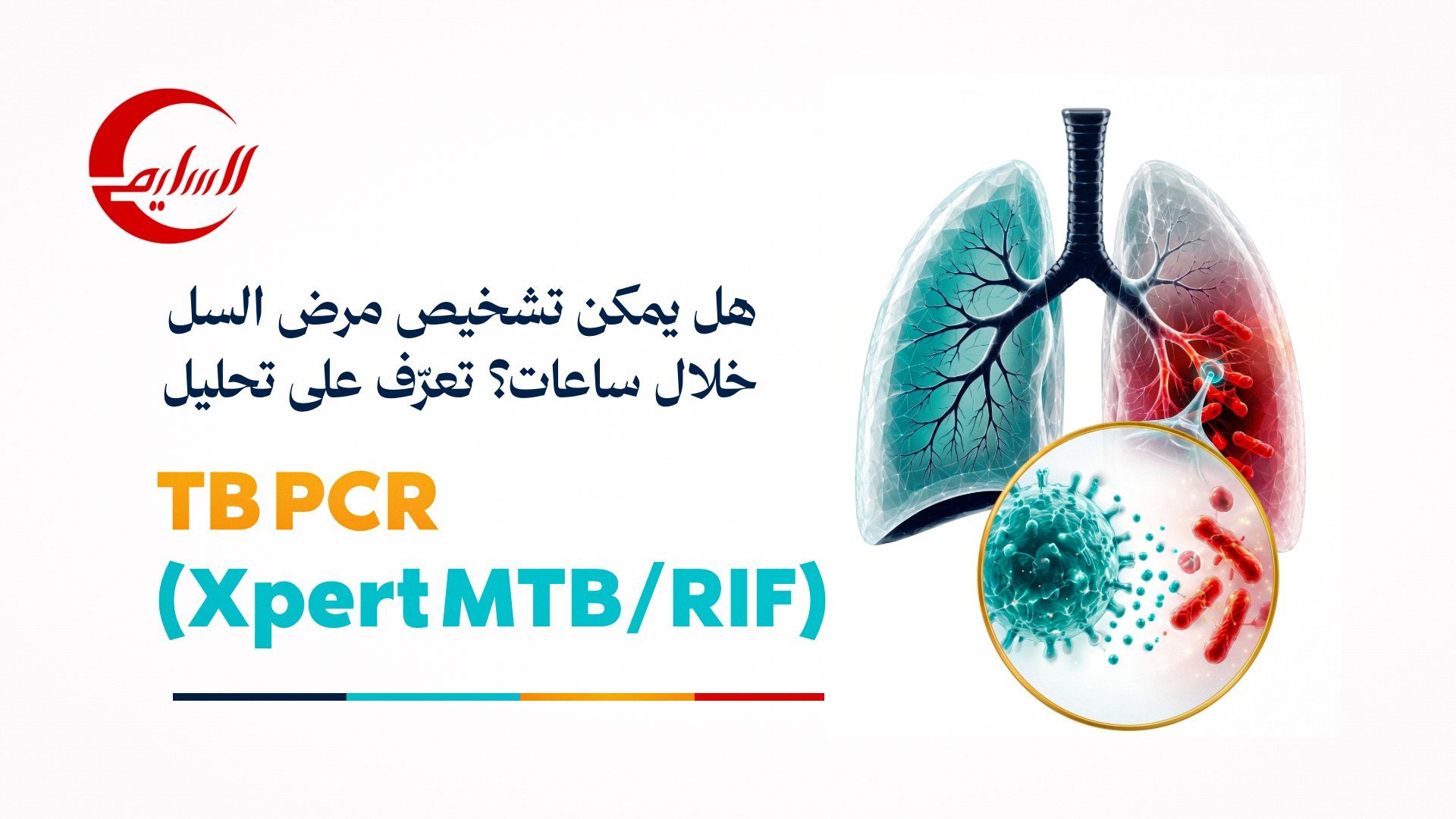 Can Tuberculosis Be Diagnosed Within Hours? Discover the TB PCR (Xpert MTB/RIF) Test